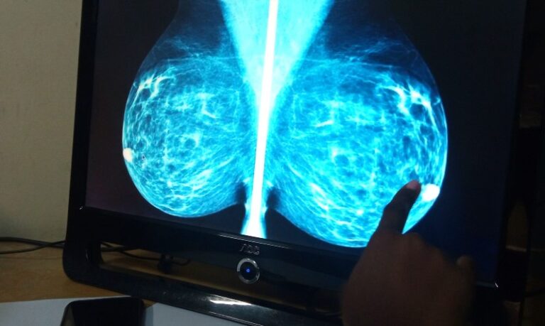 cuanto-cuesta-una-mamografia-en-estados-unidos