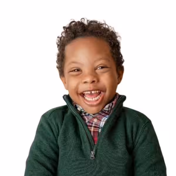 can-african-american-people-have-down-syndrome